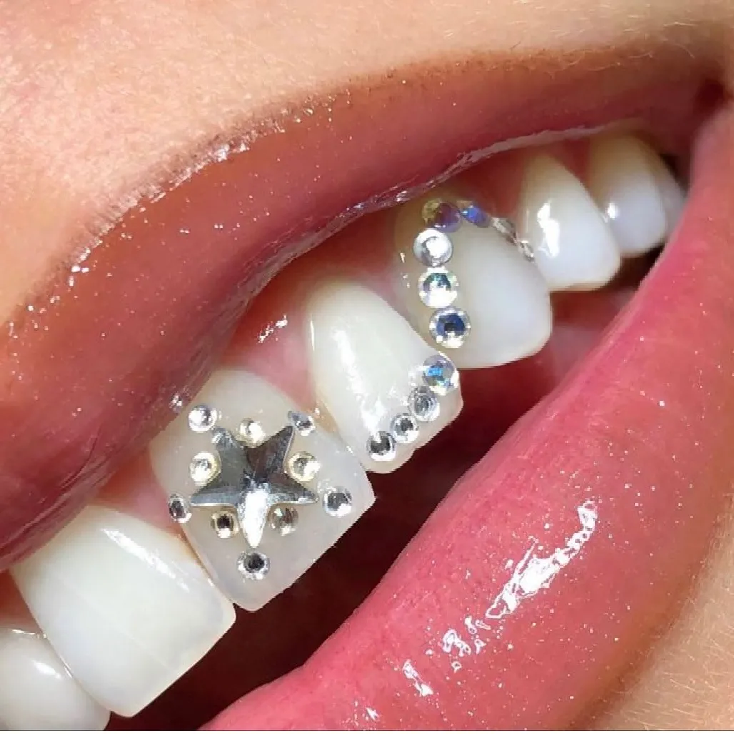 Custom Swarovski crystal tooth gems designs South Auckland