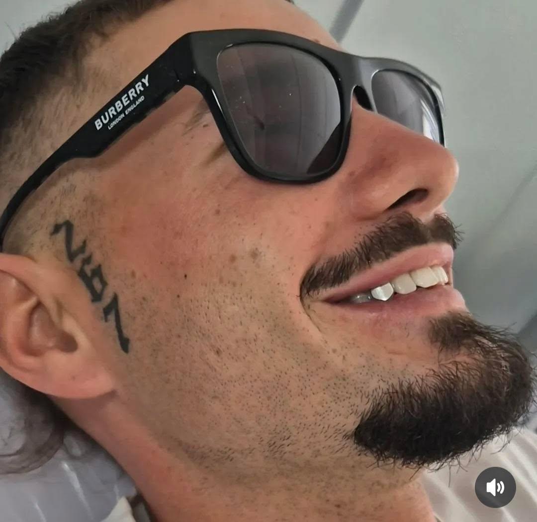 Beautiful smile transformation from teeth whitening in South Auckland